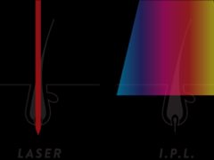 IPL-vs-Laser-Graphic.png